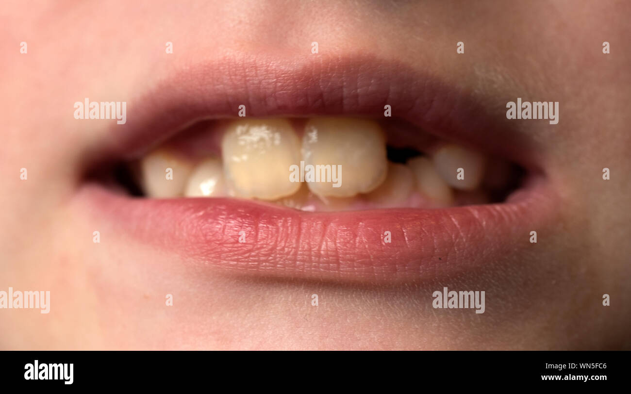 Makroaufnahme der menschlichen Zähne Stockfoto
