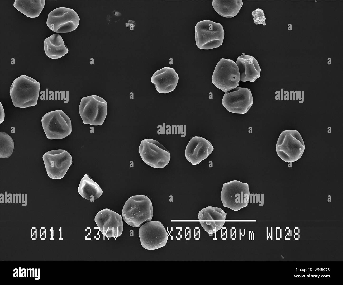 Viele hainbuche Pollenkörner Scanning Electron Micrograph Stockfoto