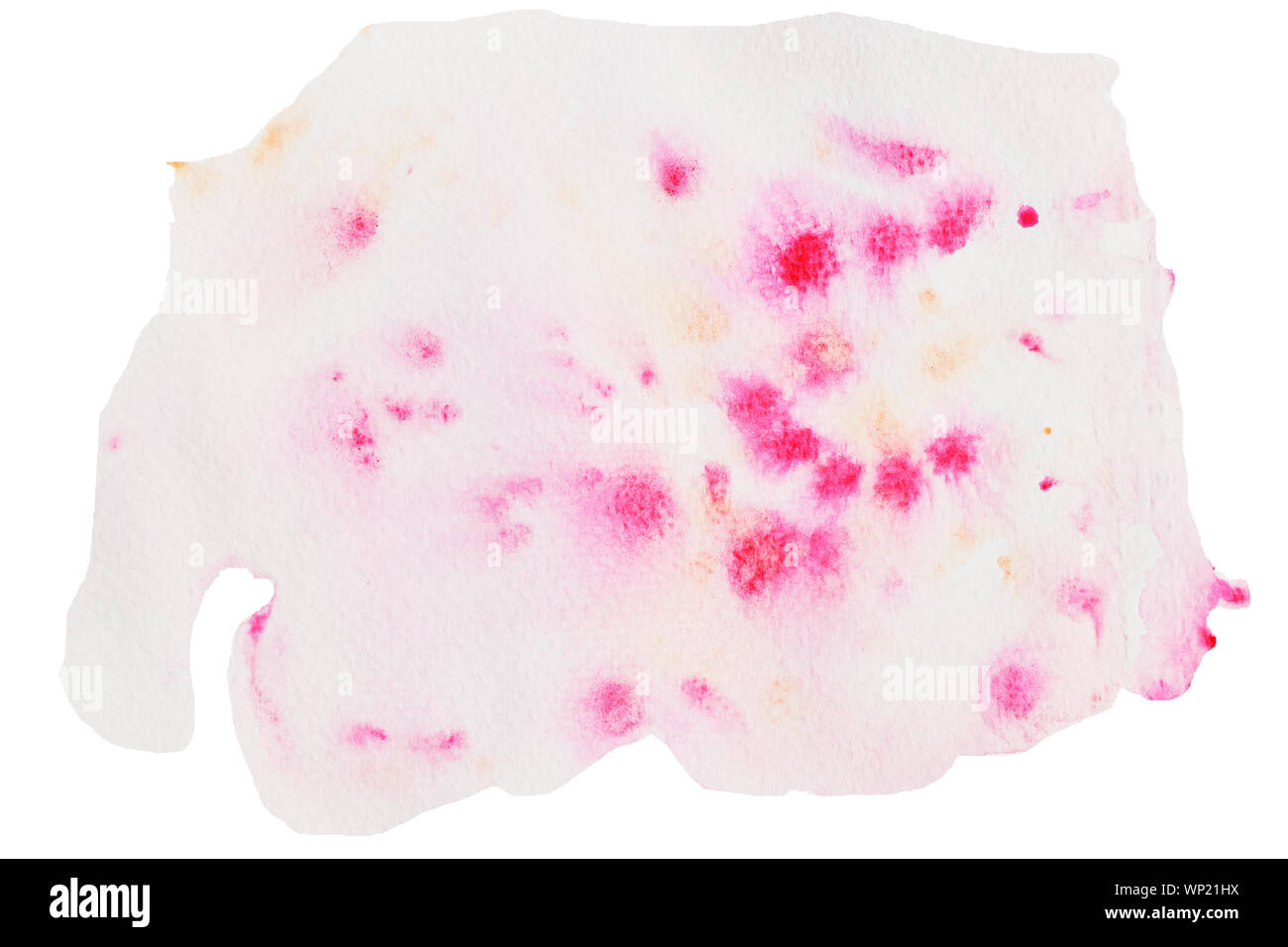 Red dot-gruppe auf rosa Farbe Oberfläche auf weißem Hintergrund, Akne mit stachelige Hitze und Hautausschläge auf empfindliche Haut, Illustration aquarell Hand zeichnen Stockfoto