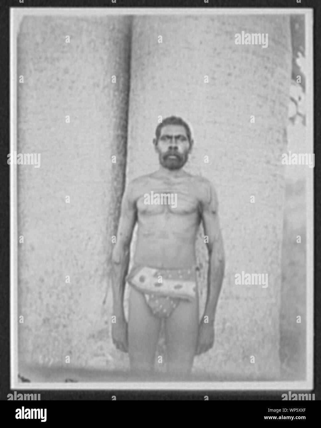 Könige [sic] Sound - Aborigines Mann im Lendenschurz, mit Brust und Armen mit rituellen Narben bedeckt Stockfoto