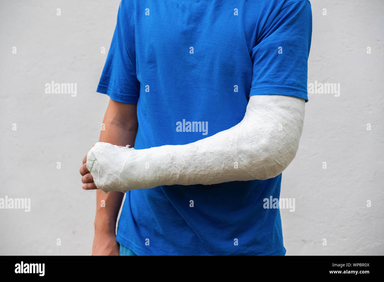 Arm gebrochen gips juckt