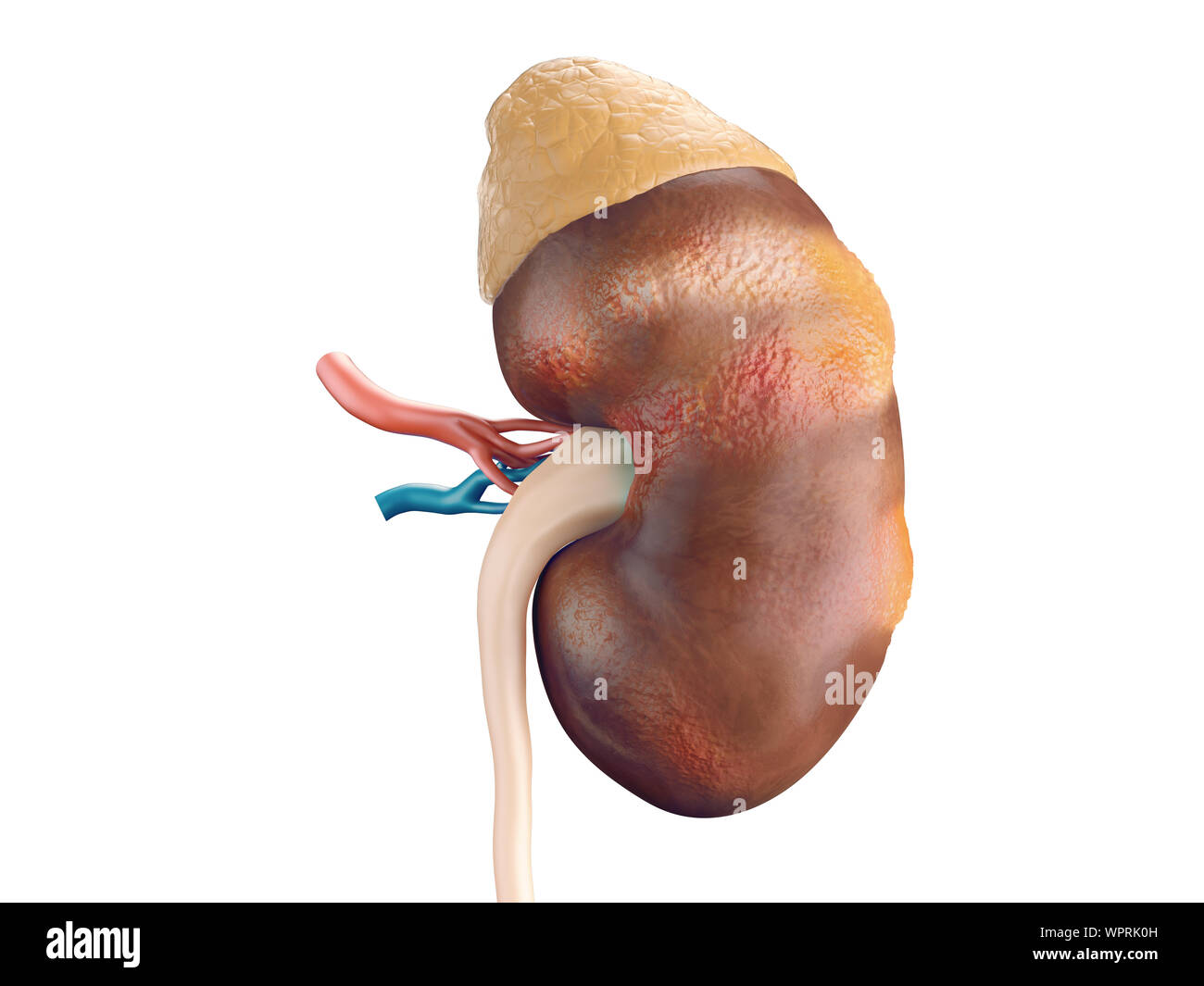 Fotorealistische 3D-Darstellung der Krankheit Krebs der menschlichen Niere mit Nebenniere und Gefäße isoliert auf weißem Stockfoto