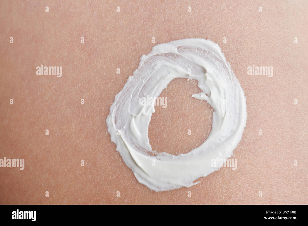 Die Anwendung Weiß Creme auf der Haut. Auf dem Gesicht haut Nahaufnahme Sunscreen Stockfoto