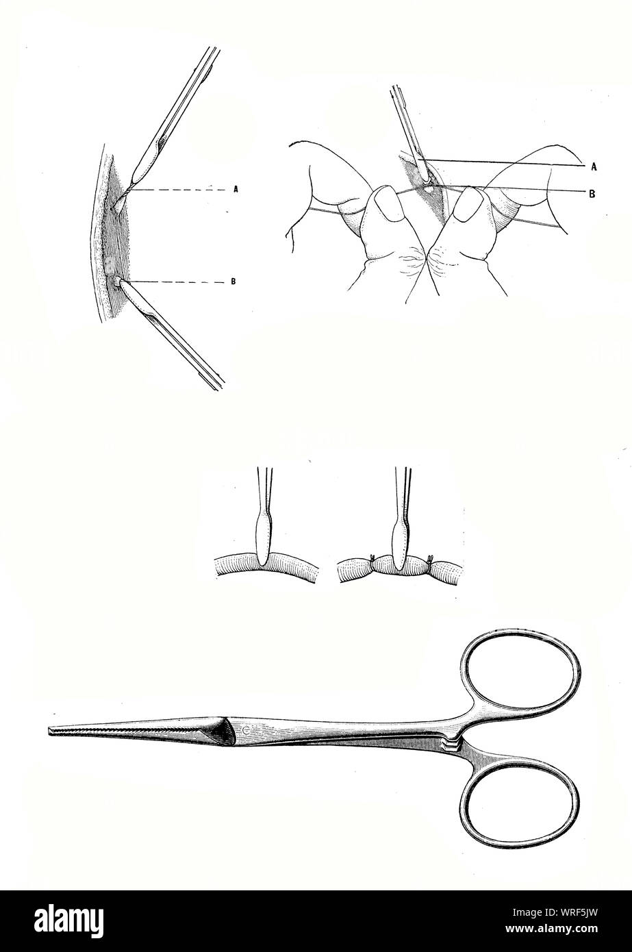 Chirurgie und Medizin - blutstillung Schelle, chirurgische Instrument zu Blutungen während einer Operation vor dem Sichern mit einer Ligatur. Stockfoto