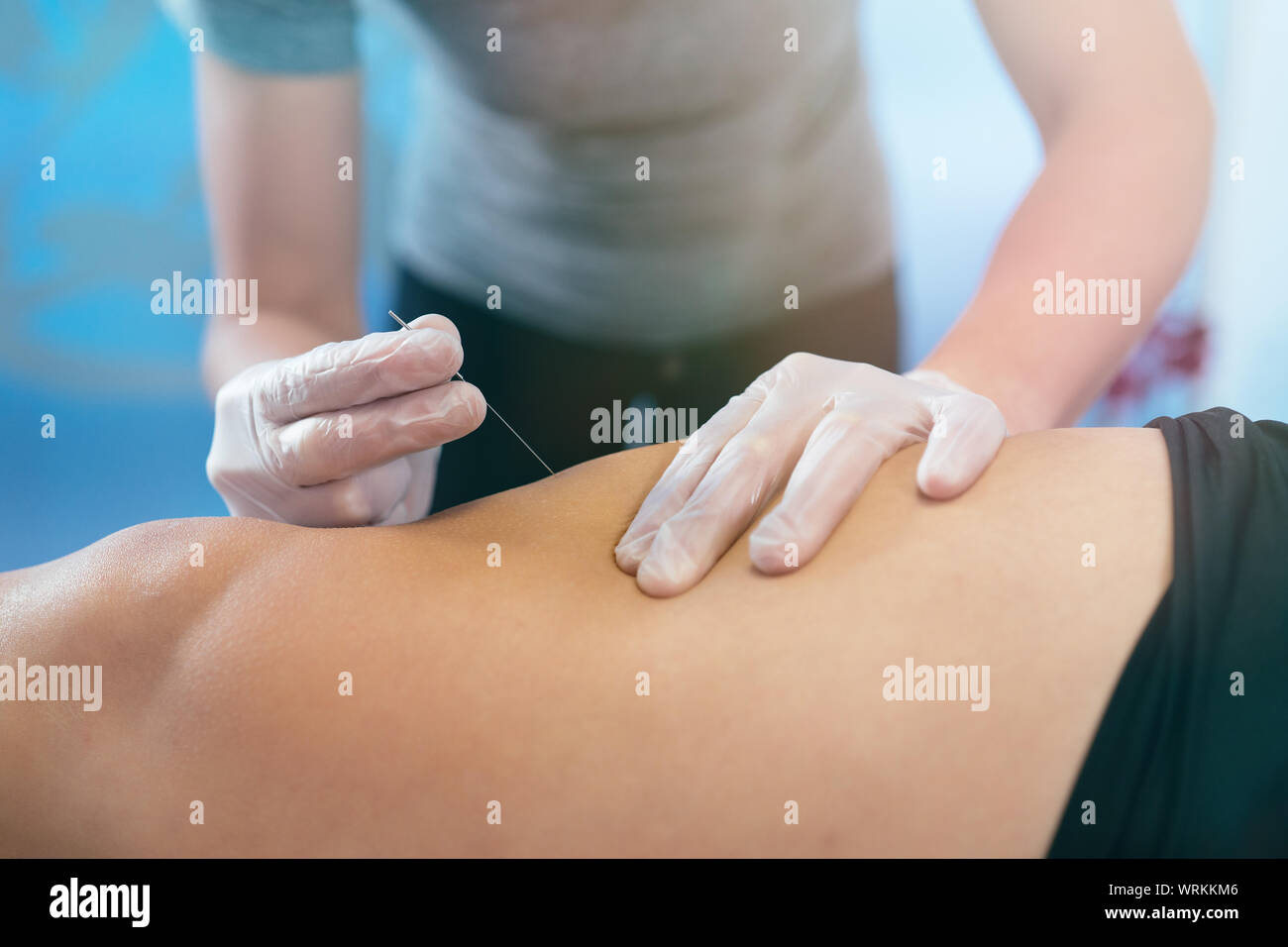 Einfügen einer kleinen Nadel in das Bein des Patienten mit den Händen von medizinischen Handschuhen bedeckt. Entspannung Konzept. Close-up Stockfoto