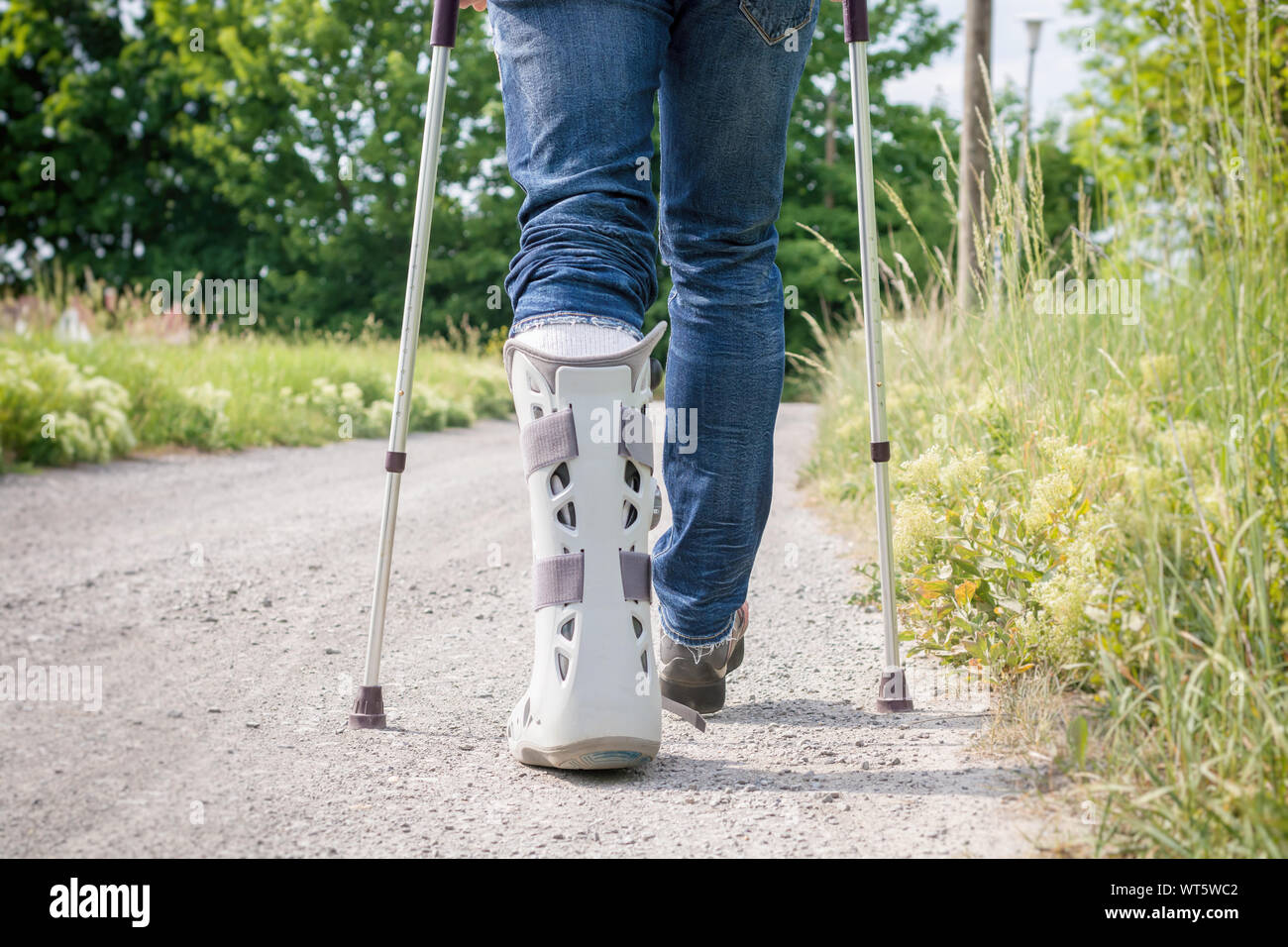 Schiene im Fuß und Unterschenkel Bereich nach Ruptur der Achillessehne  Stockfotografie - Alamy