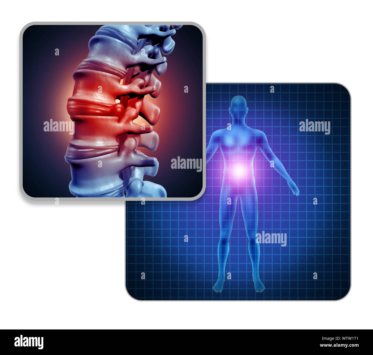 Menschliche zurück Gelenkschmerzen Konzept als Skelett und Muskel Anatomie des Körpers mit Rückenschmerzen Wirbelsäule Gelenke wie eine schmerzhafte Arthritis Rückenschmerzen Verletzung oder Krankheit. Stockfoto