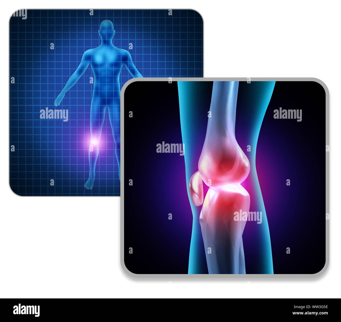 Menschlichen Knie Körper Gelenkschmerzen Konzept wie ein Skelett und Muskel Anatomie des Körpers als schmerzhafte Beinverletzung oder Arthritis Krankheit Symbol. Stockfoto