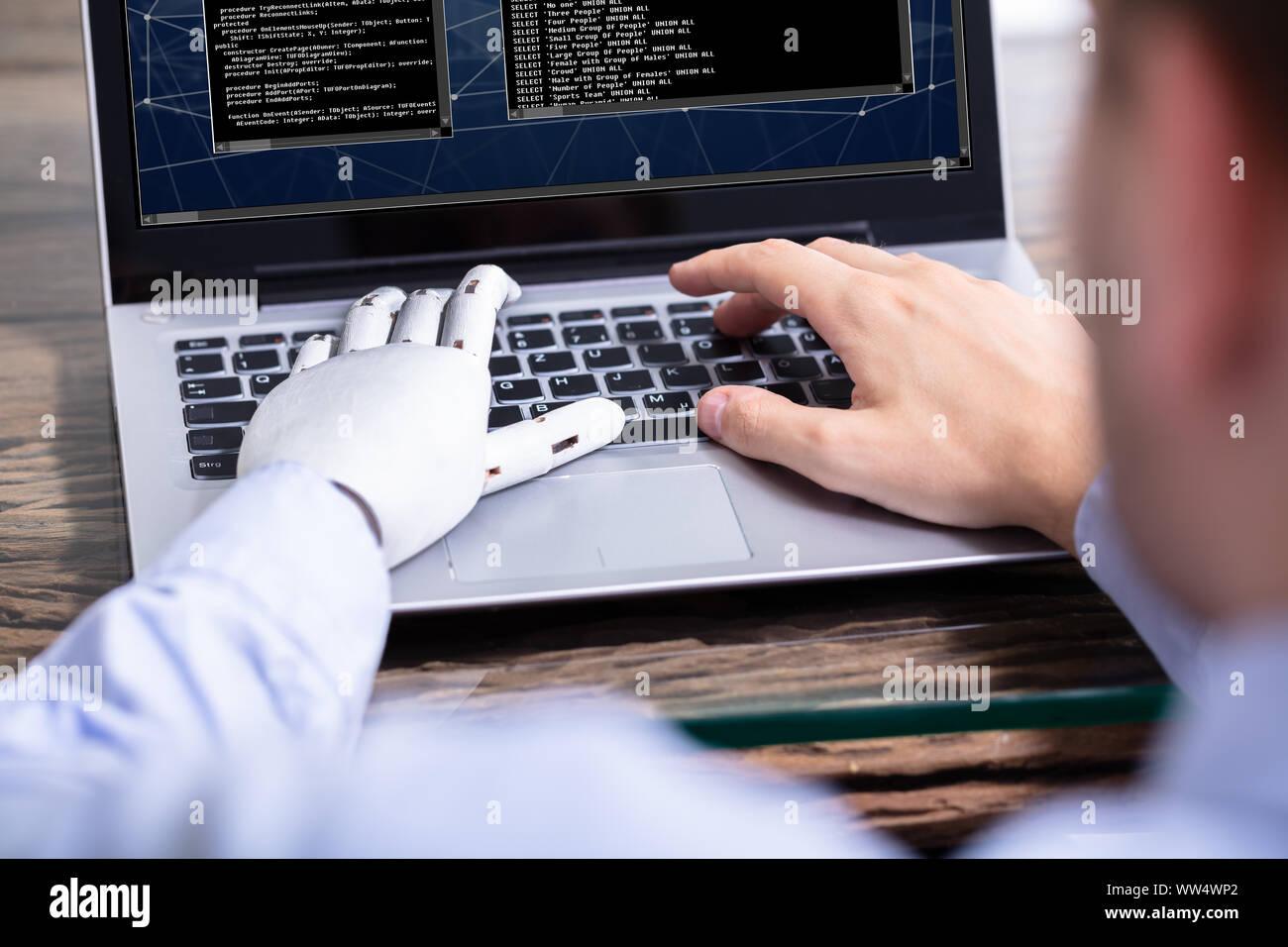 Mann mit prothetischen Arbeiten am Laptop. Künstliche Gliedmaßen Stockfoto