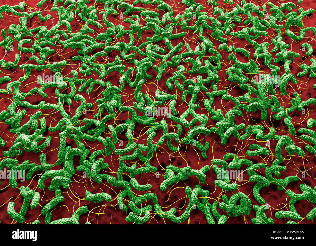 Cholera bakterielle Besiedlung auf Darmwand Stockfoto