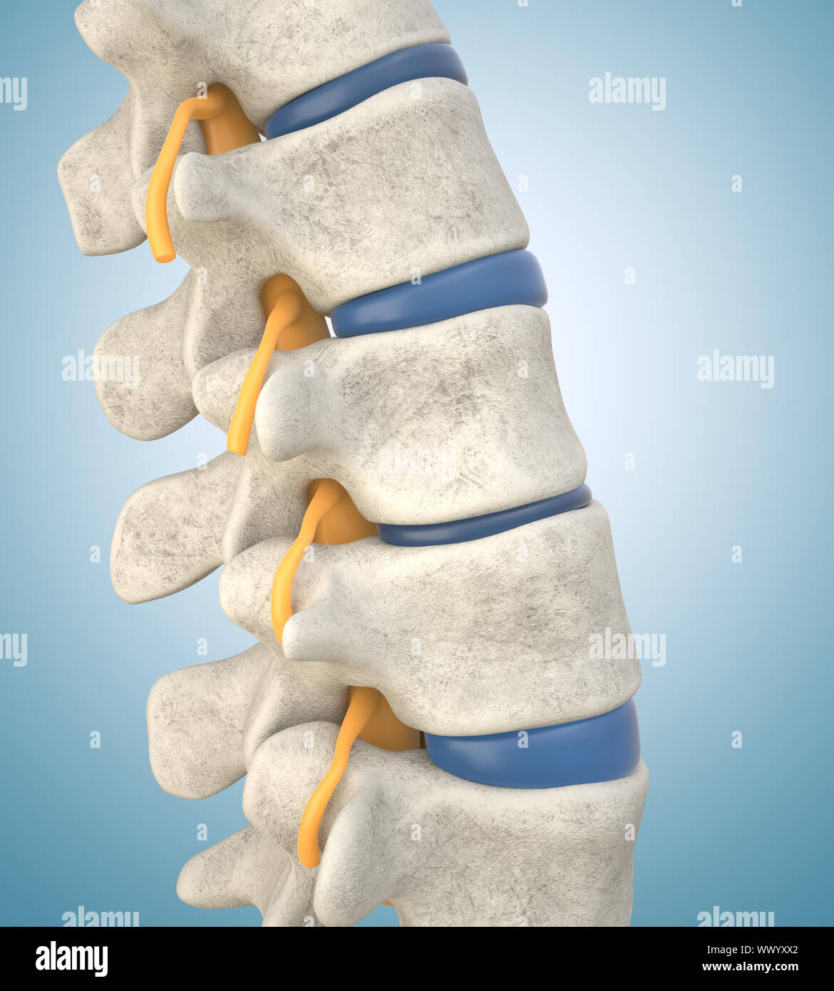 Die lendenwirbelsäule Modell demonstriert ausgedünnt Disc. 3D