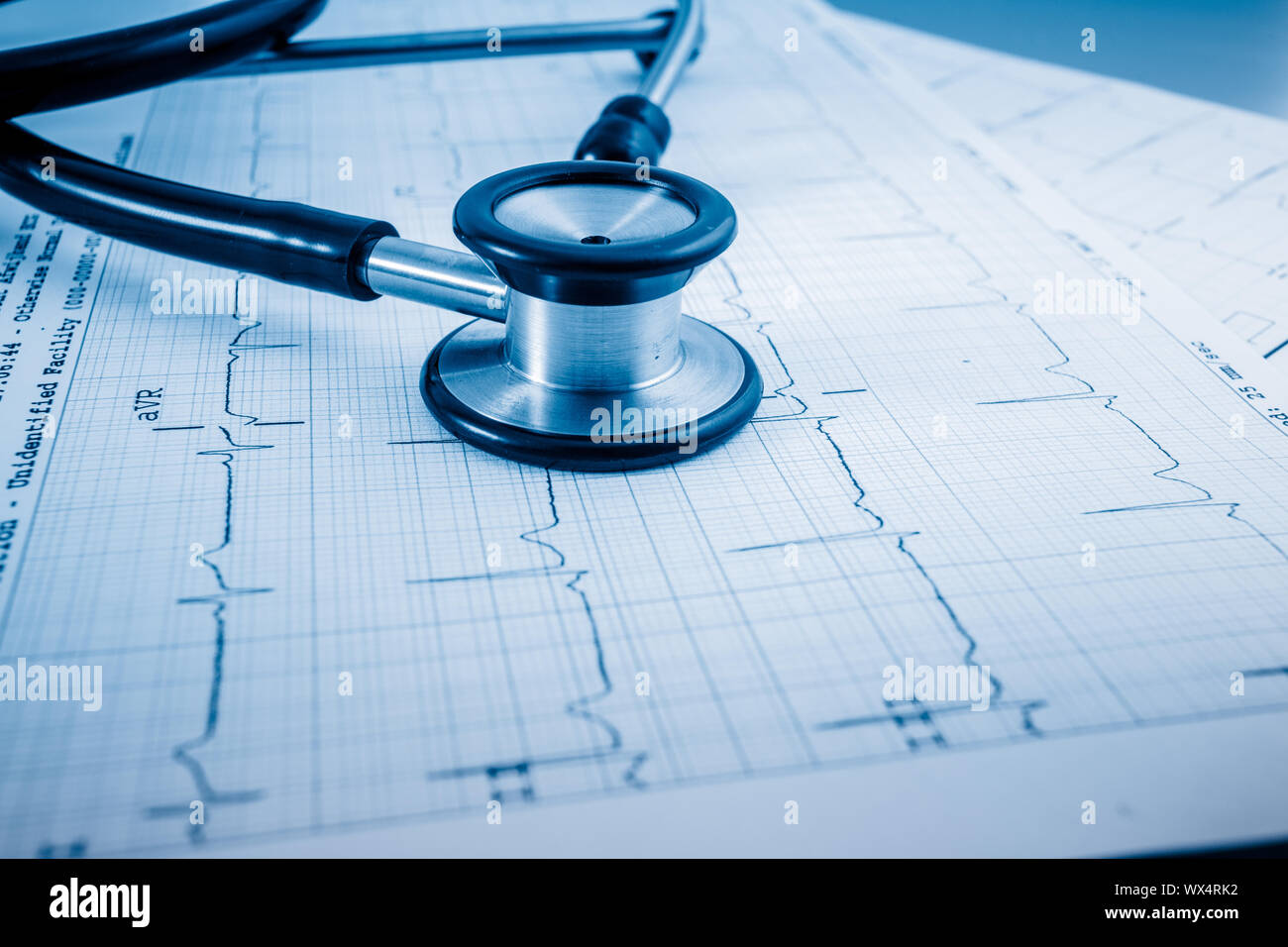 Stethoskop auf EKG-Konzept für die Herz-Pflege Stockfoto