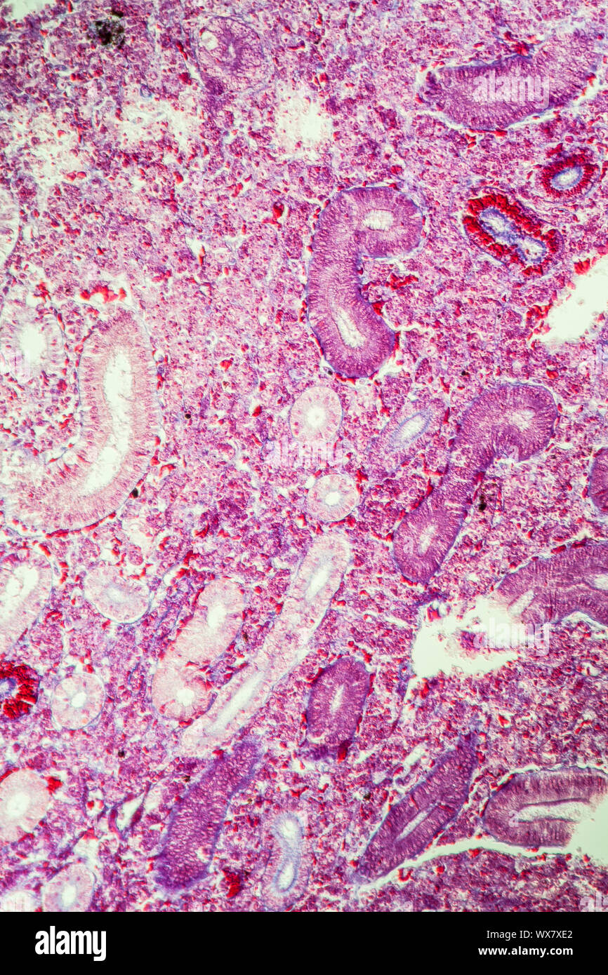 Hecht Niere Querschnitt 100 x Stockfoto