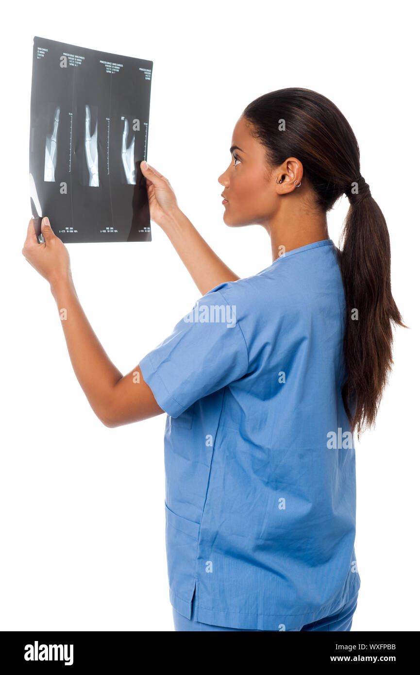 Junge Ärztin Analyse x-ray Bericht über ihre Patienten Stockfoto