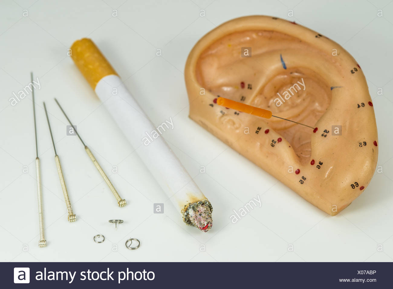 Akupunktur, mit dem Rauchen aufzuhören Stockfotografie - Alamy