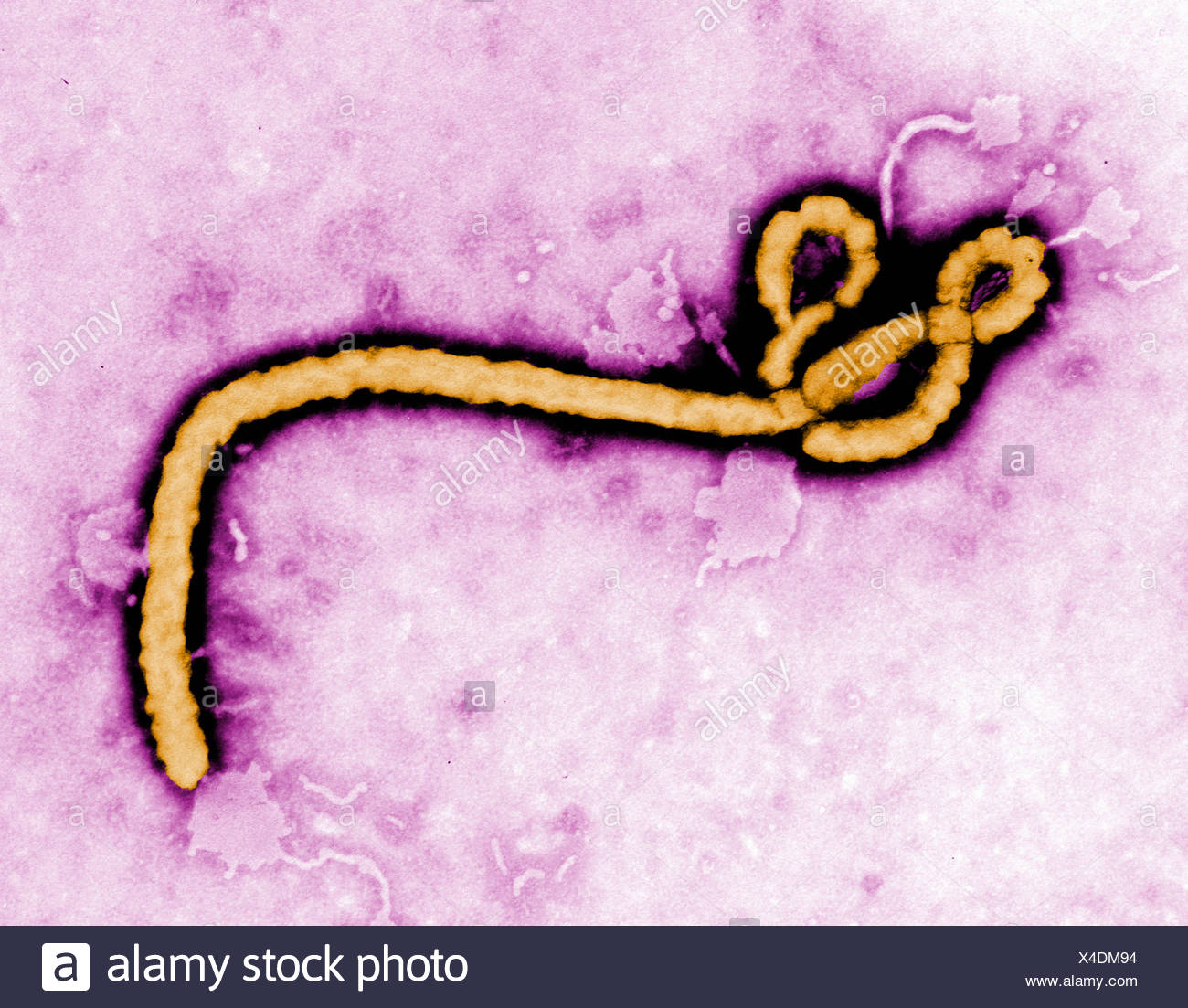 Transmission Electron Schliffbild Des Ebola Virus Stockfotografie Alamy