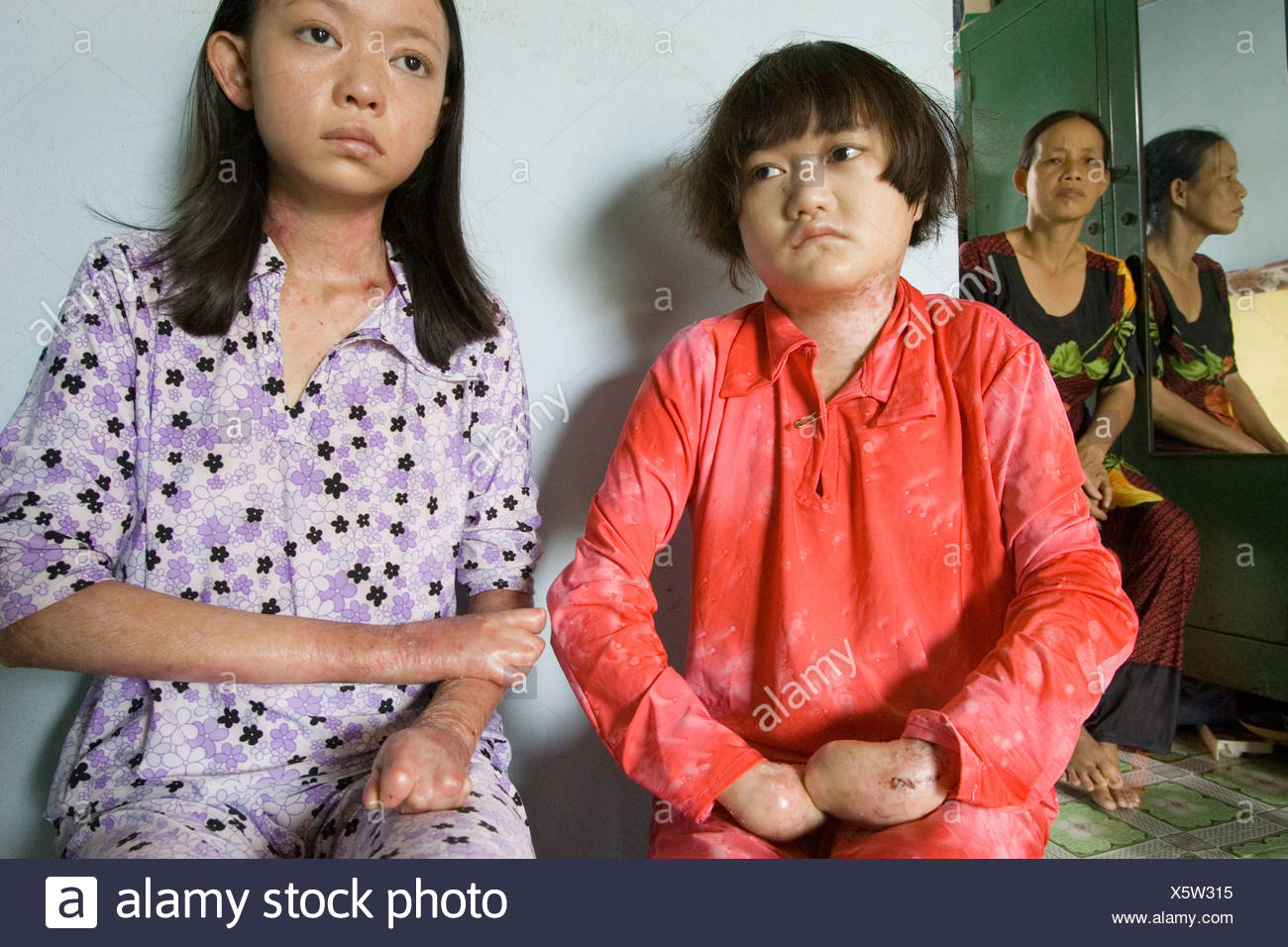 Agent Orange Victim Vietnam Stockfotos Und Bilder Kaufen Alamy Agent Orange Victim Vietnam Stockfotos Und Bilder Kaufen Alamy