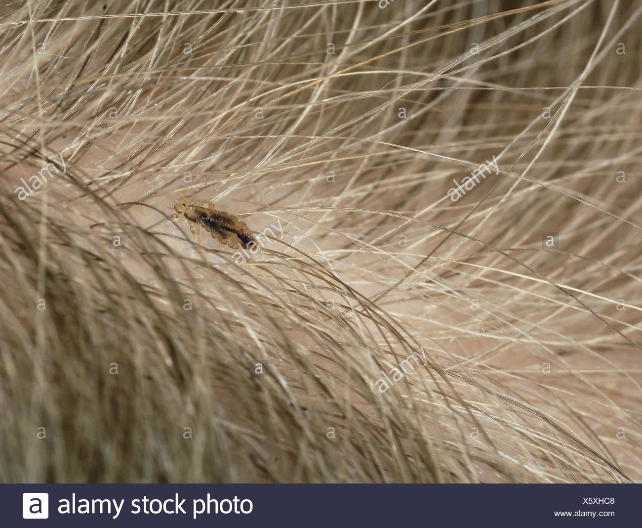 Zoologie Tiere Insekten Kopf Laus Pediculus Humanus Capitis Grosse 3mm In Der Das Haar Eines Kindes Deutschland Stockfotografie Alamy