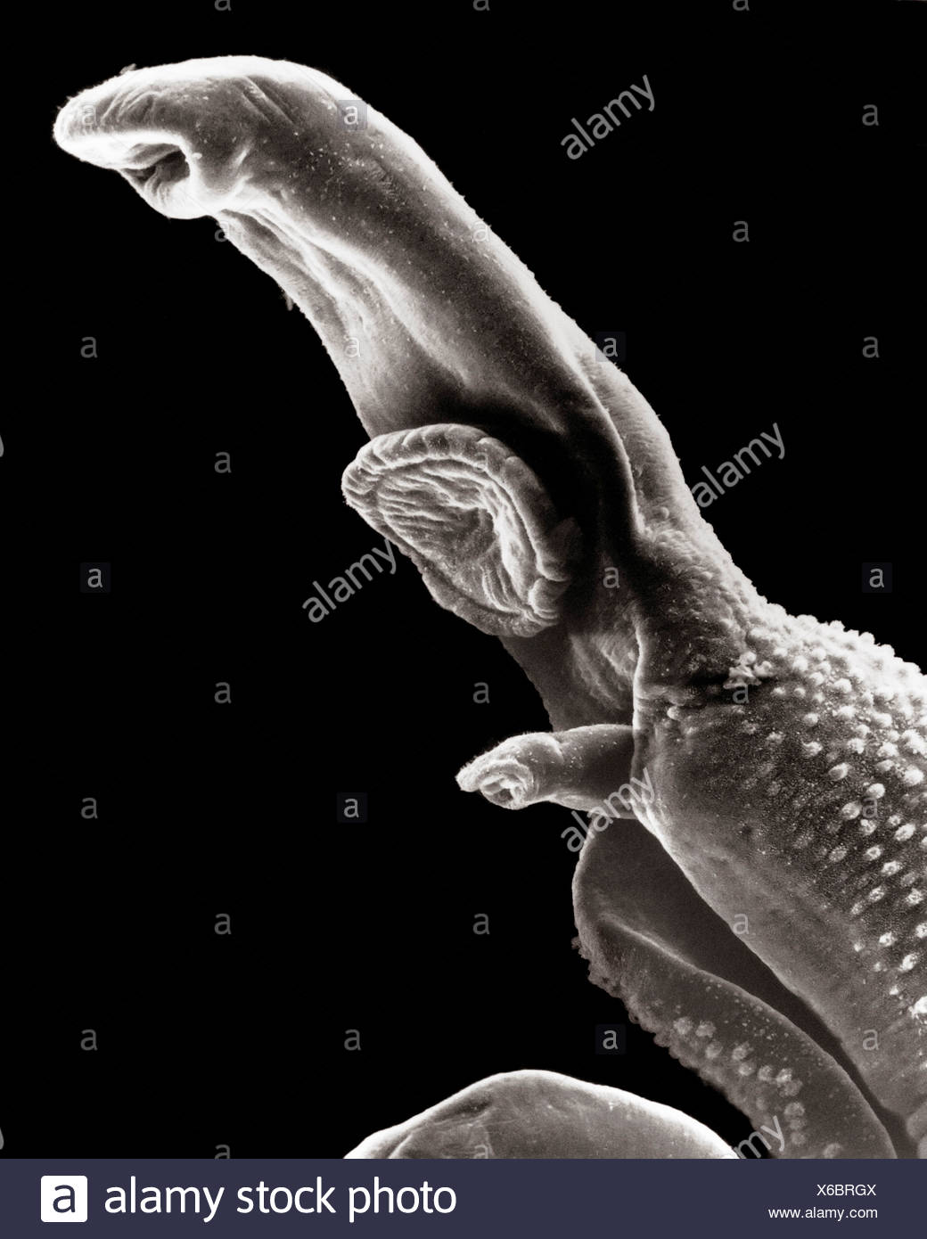 Schistosomiasis Infection Stockfotos Und Bilder Kaufen Alamy