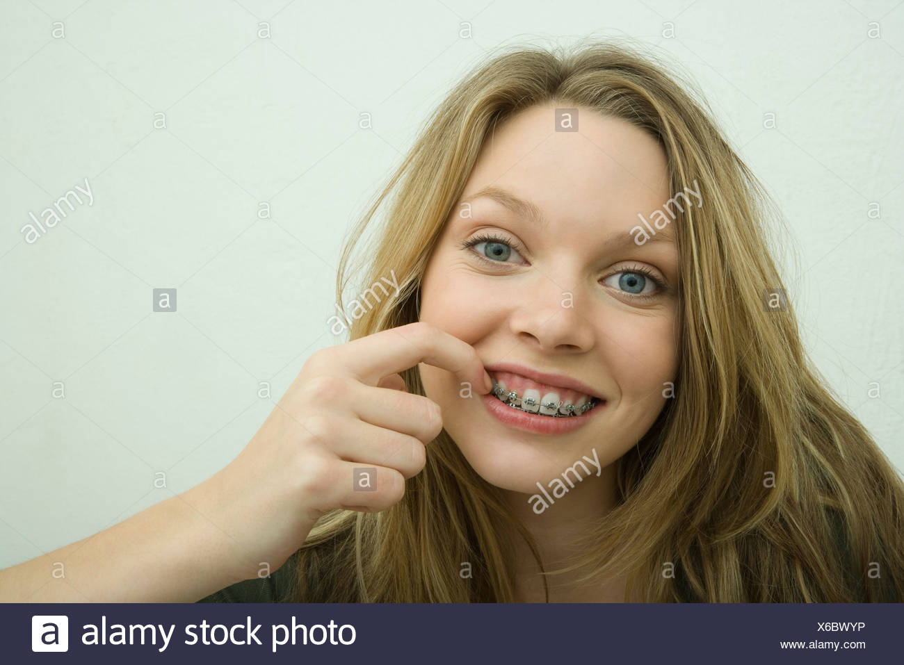 Teen Mit Zahnspange Teen Mit Zahnspange