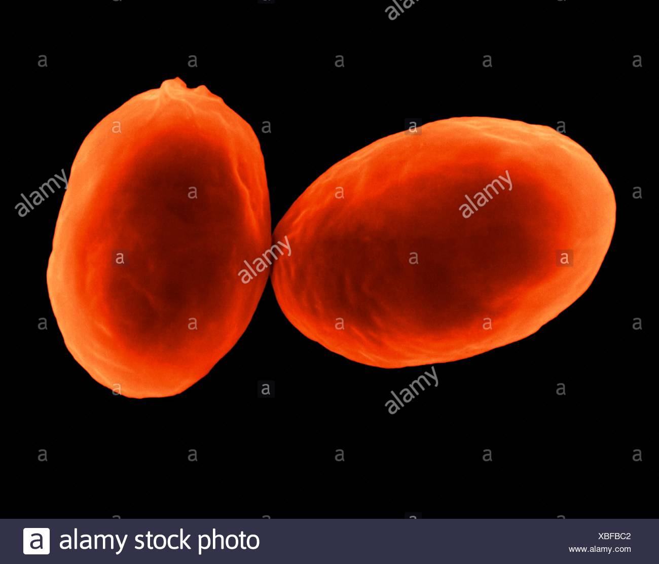 Giardia Lamblia Ein Protozoen Zyste Buhne Gefunden In Wasser Verunreinigt Durch Tierkot Farbige Scanning Electron Schliffbild Sem Protozoen Infektion Bekannt Als Giardiasis Verursacht Parasitare Protozoen Die Giardiasis Giardia Lamblia