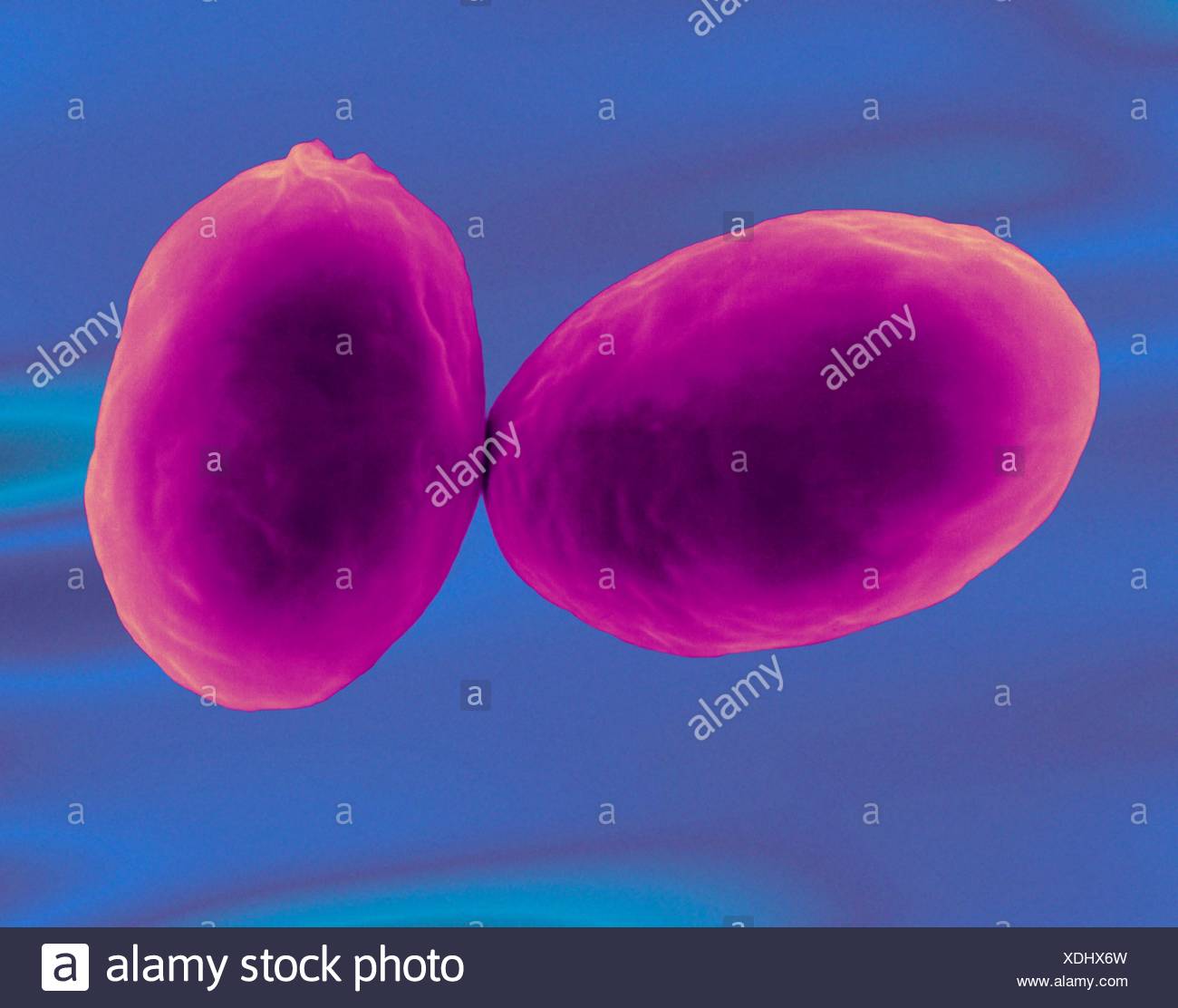 Giardia Lamblia Ein Protozoen Zyste Buhne Gefunden In Wasser Verunreinigt Durch Tierkot Farbige Scanning Electron Schliffbild Sem Protozoen Infektion Bekannt Als Giardiasis Verursacht Parasitare Protozoen Die Giardiasis Giardia Lamblia