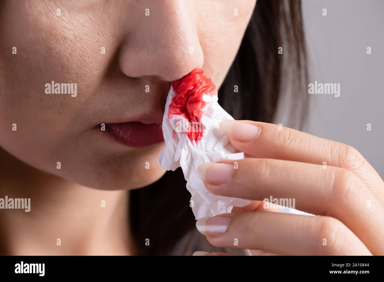 Nariz de sangre Fotos e Imágenes de stock Página 10 Alamy