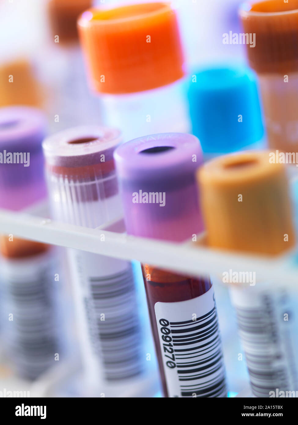 Una fila de muestras de sangre humana en espera de las pruebas en el laboratorio Foto de stock