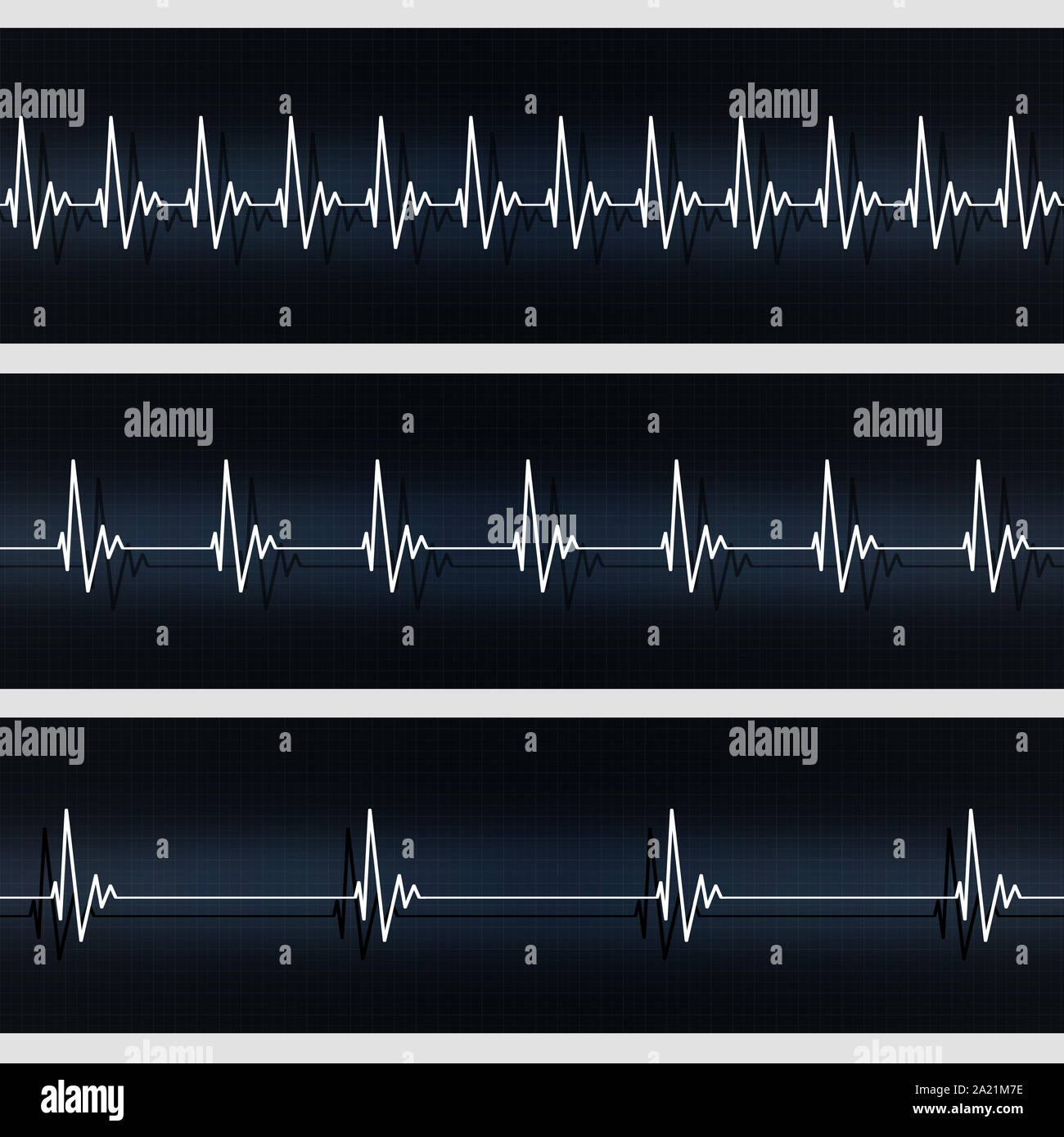 Médicos de cardiología banners latido normal y rápida latidos cardíacos  lentos Fotografía de stock - Alamy