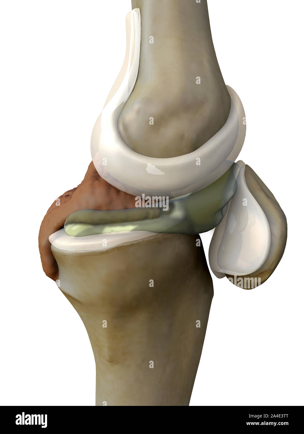 Dolor de rodilla ilustración ilustración 3d lateral, lateral de la rodilla  Radiografía de la rodilla Fotografía de stock - Alamy