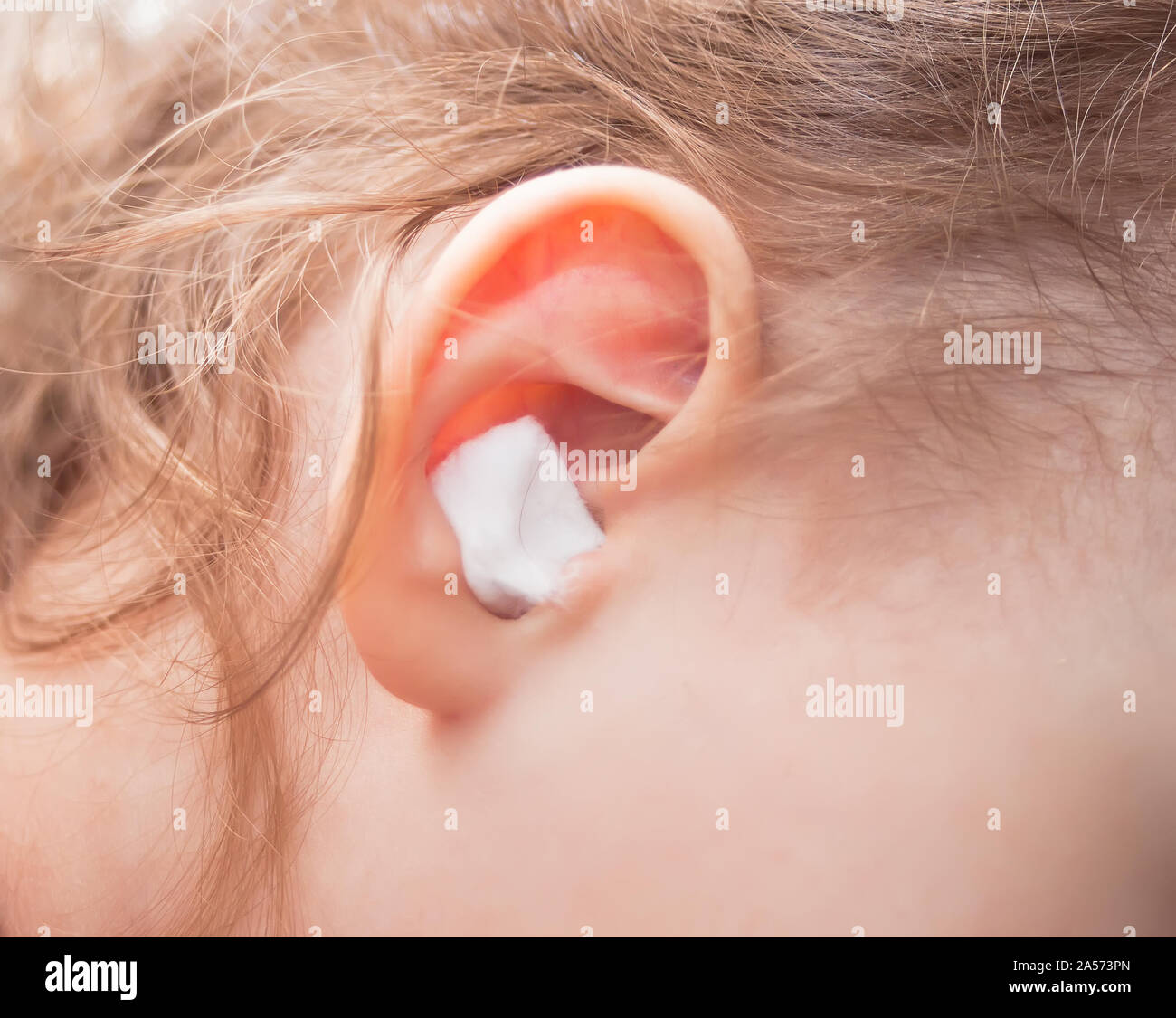 Niña con dolor de oído y algodón en un oído Fotografía de stock - Alamy