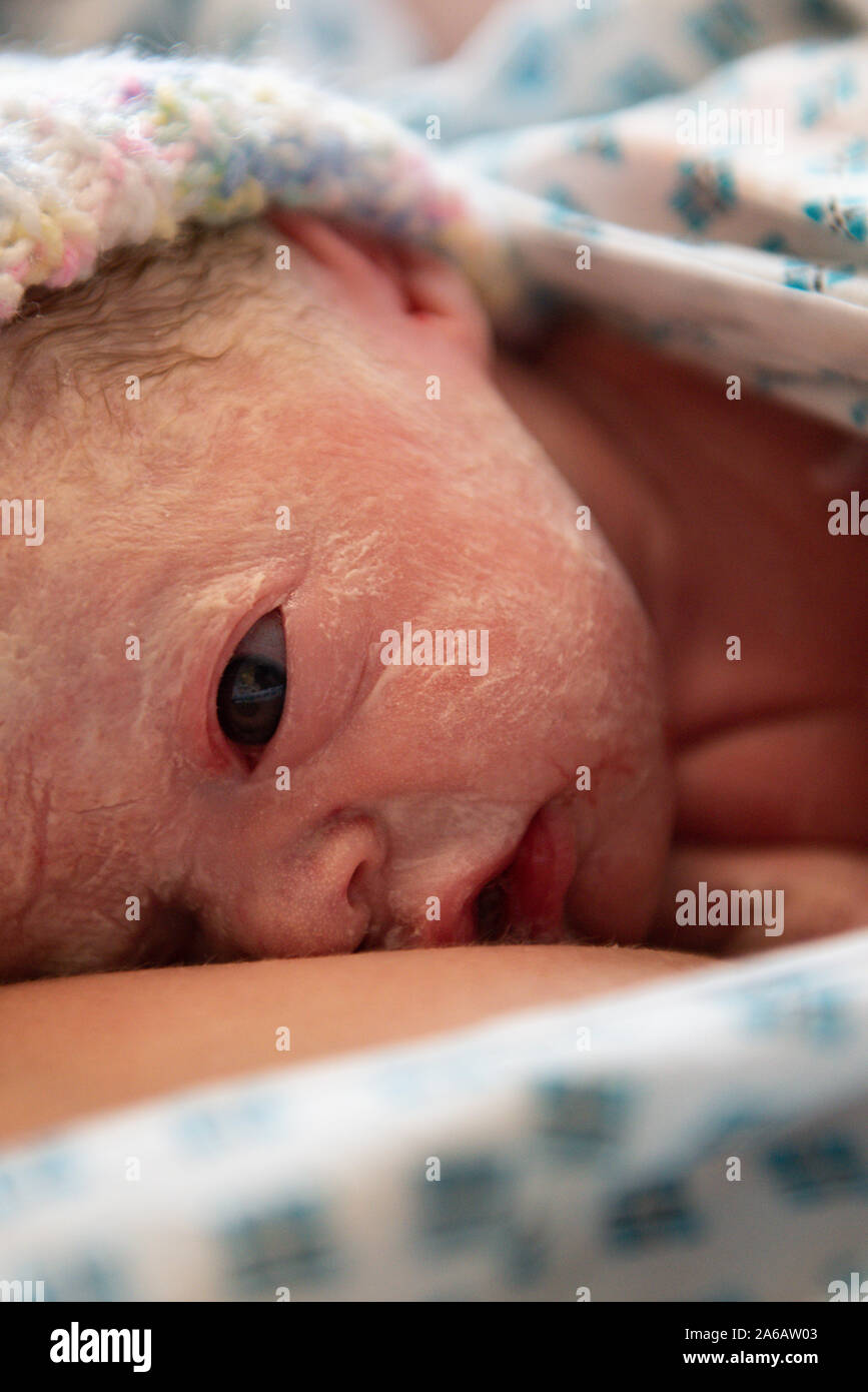 Una joven muchacha del bebé prematuro nace con un peso de sólo 4kg, retratada aquí a menos de 5 minutos de antigüedad Foto de stock