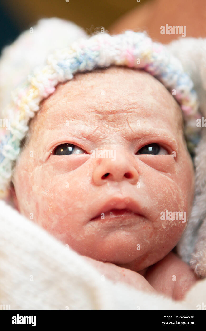 Una Joven Muchacha Del Bebe Prematuro Nace Con Un Peso De Solo 4kg Retratada Aqui A Menos De 5 Minutos De Antiguedad Fotografia De Stock Alamy