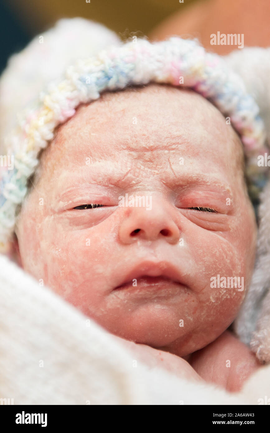 Una Joven Muchacha Del Bebe Prematuro Nace Con Un Peso De Solo 4kg Retratada Aqui A Menos De 5 Minutos De Antiguedad Fotografia De Stock Alamy