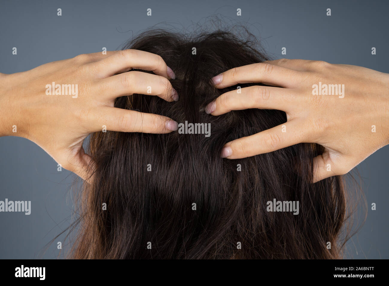 Mujer joven rascarse la cabeza picazón en el cuero cabelludo Fotografía de  stock - Alamy