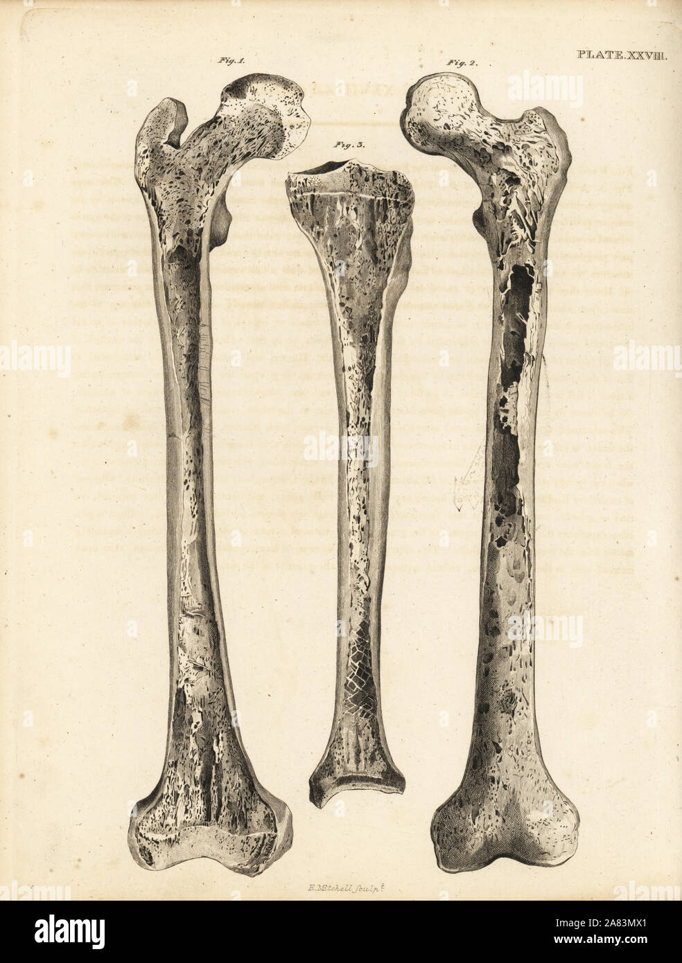 Secciones longitudinales del fémur y de la tibia 1,2 3. Copperplate grabado por Edward Mitchell después de una ilustración anatómica por Jean-Joseph Sue de John Barclay's una serie de grabados del esqueleto humano MacLachlan, y Stewart, Edimburgo, 1824. Foto de stock