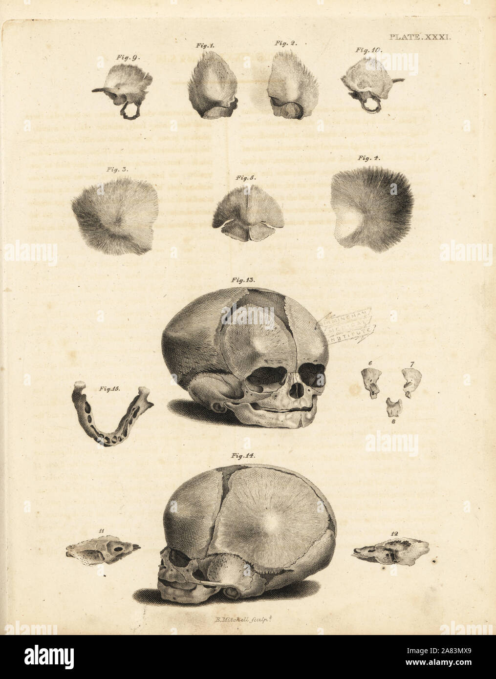 Etapas en la formación del Cráneo fetal. Copperplate grabado por Edward Mitchell después de una ilustración anatómica por Jean-Joseph Sue de John Barclay's una serie de grabados del esqueleto humano MacLachlan, y Stewart, Edimburgo, 1824. Foto de stock