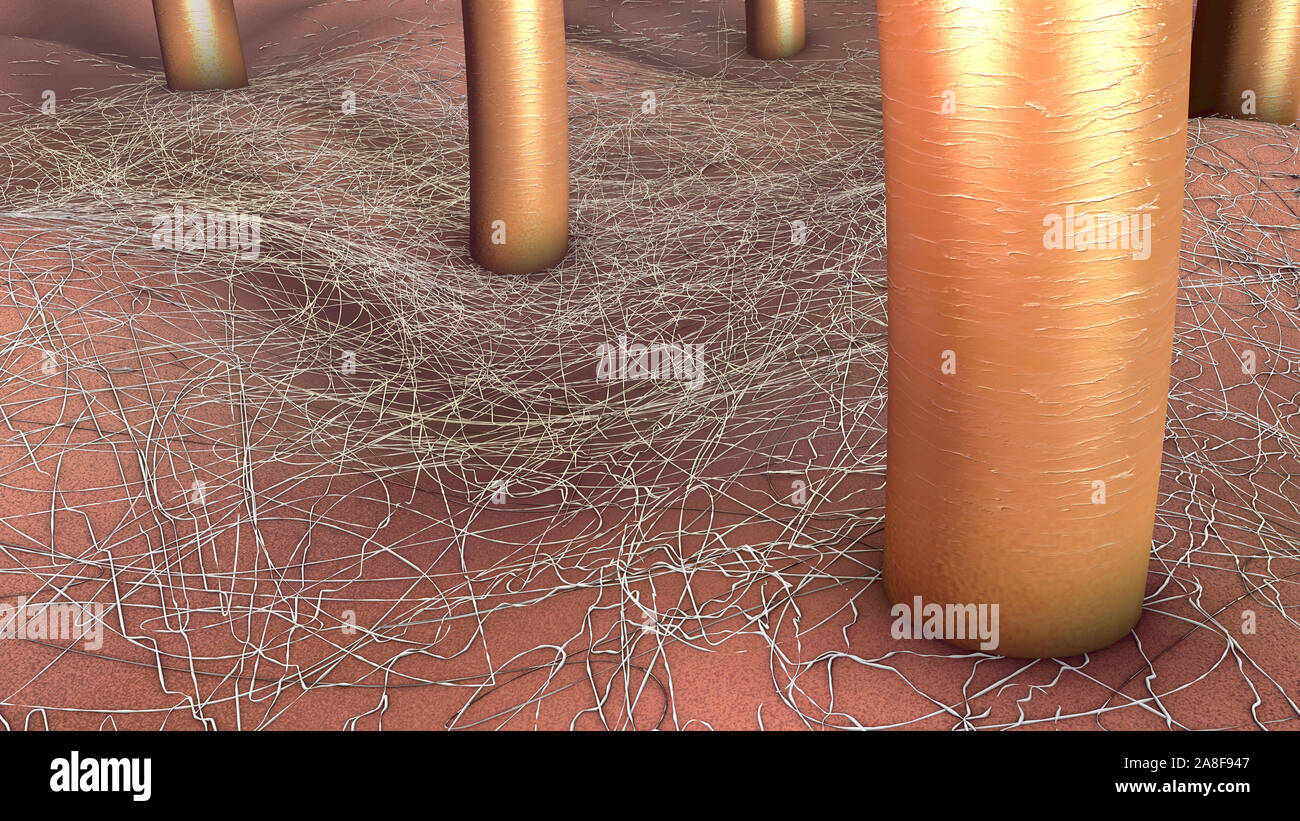 Infección cutánea micótica, ilustración Foto de stock