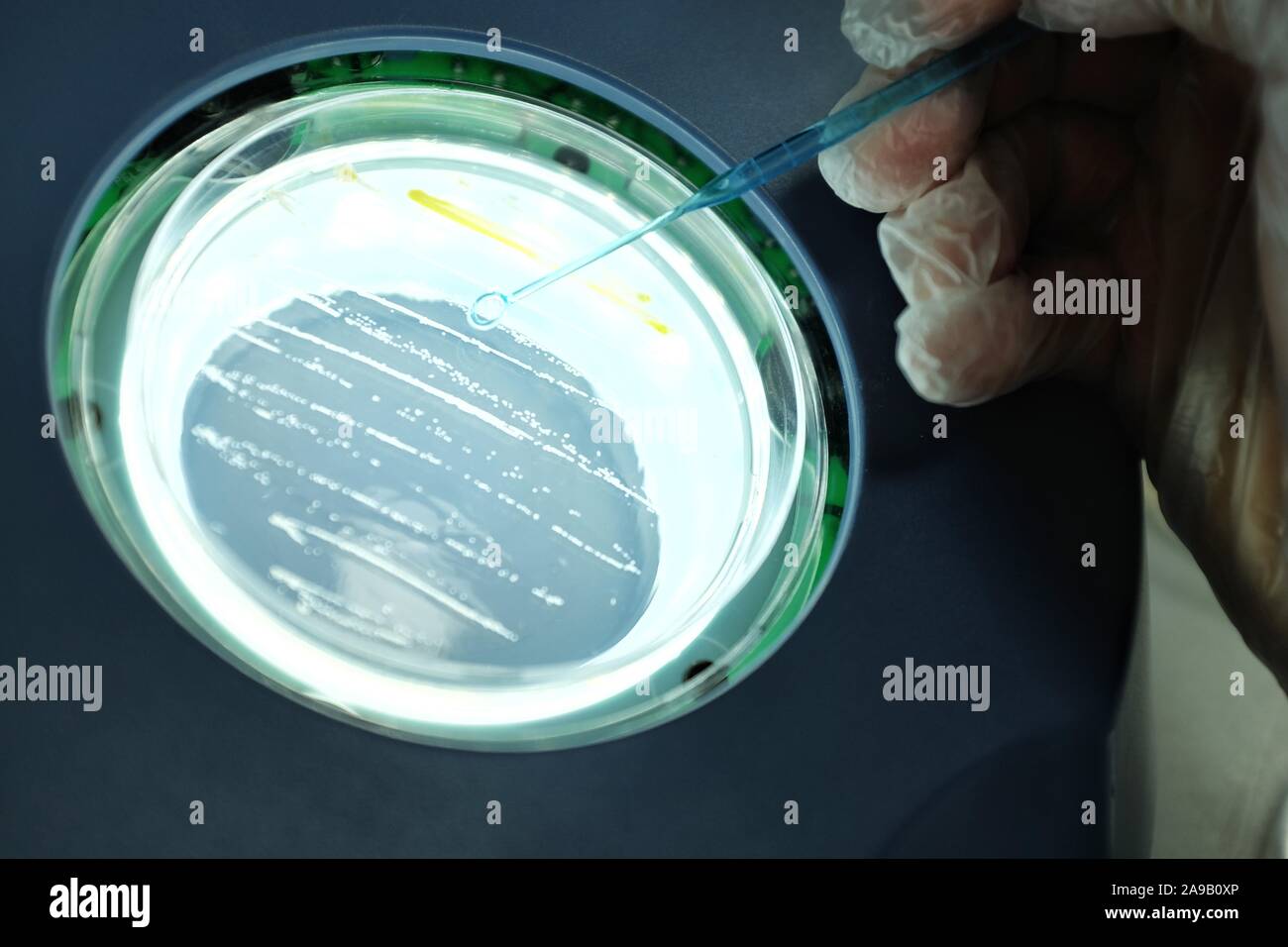 Las bacterias en la superficie de agar. Foto de stock