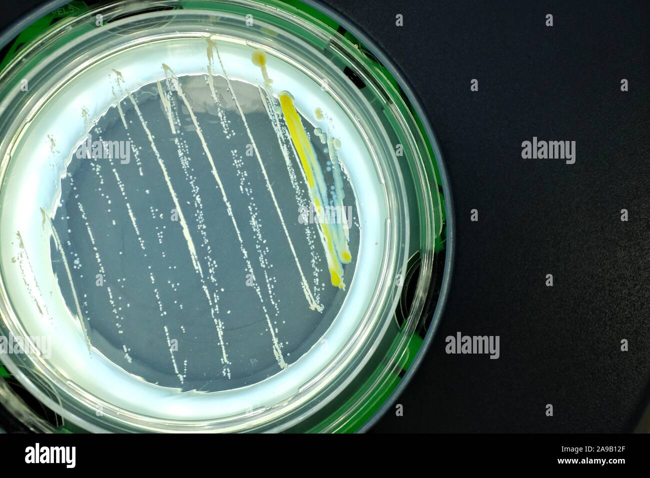 Las bacterias en la superficie de agar. Foto de stock
