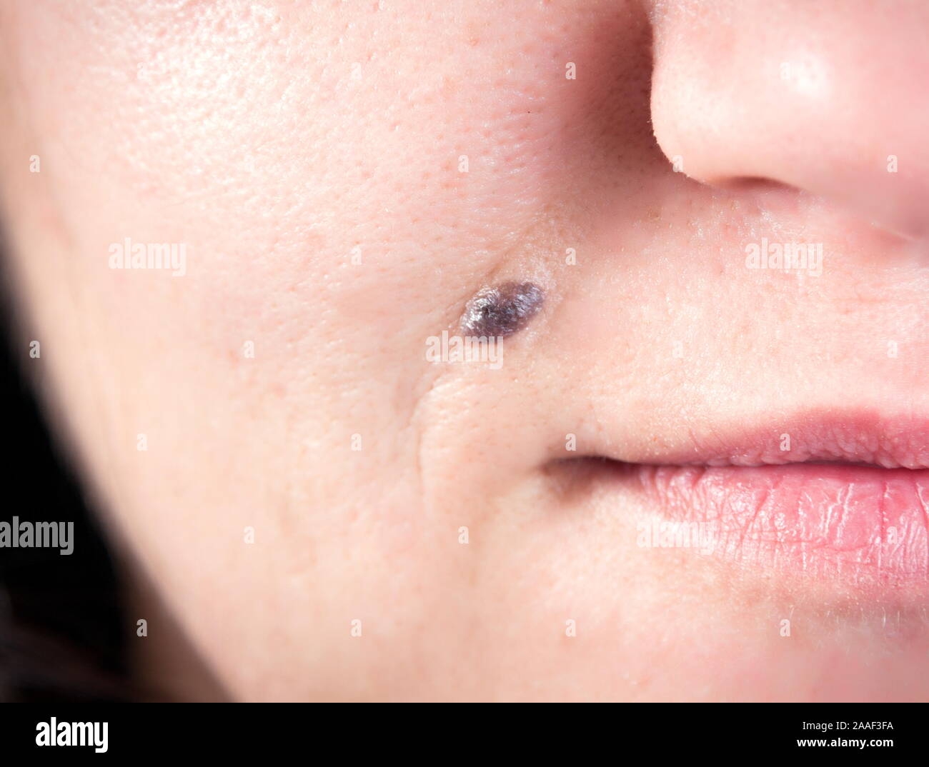Lunar en la cara de la mujer Fotografía de stock - Alamy