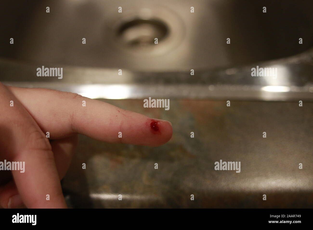 Cicatriz Del Dedo Fotos e Imágenes de stock Alamy