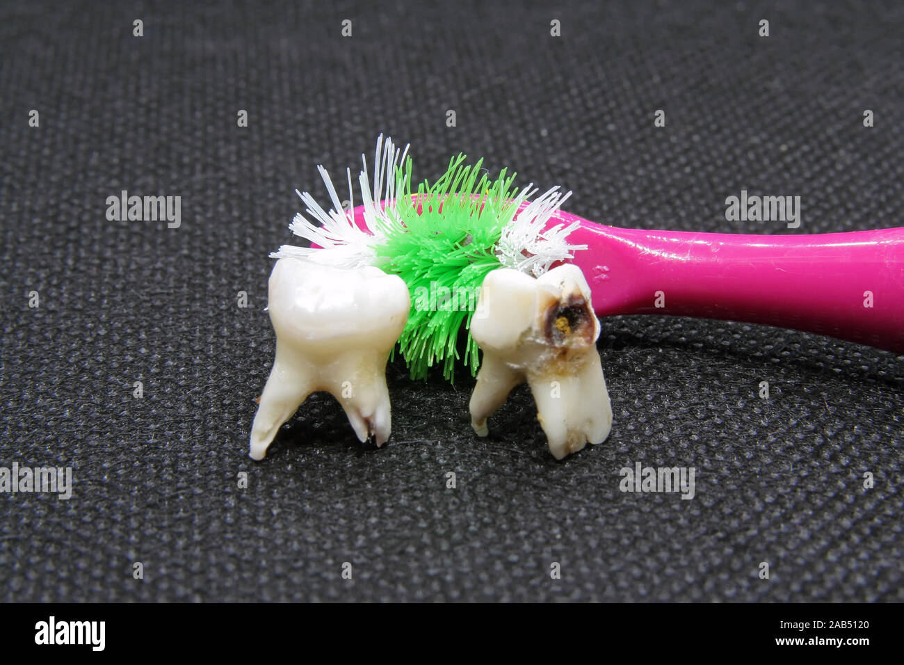 Mal diente y cepillo de dientes. La higiene dental.diente podrido y cepillo  de dientes. Diente extraído Fotografía de stock - Alamy