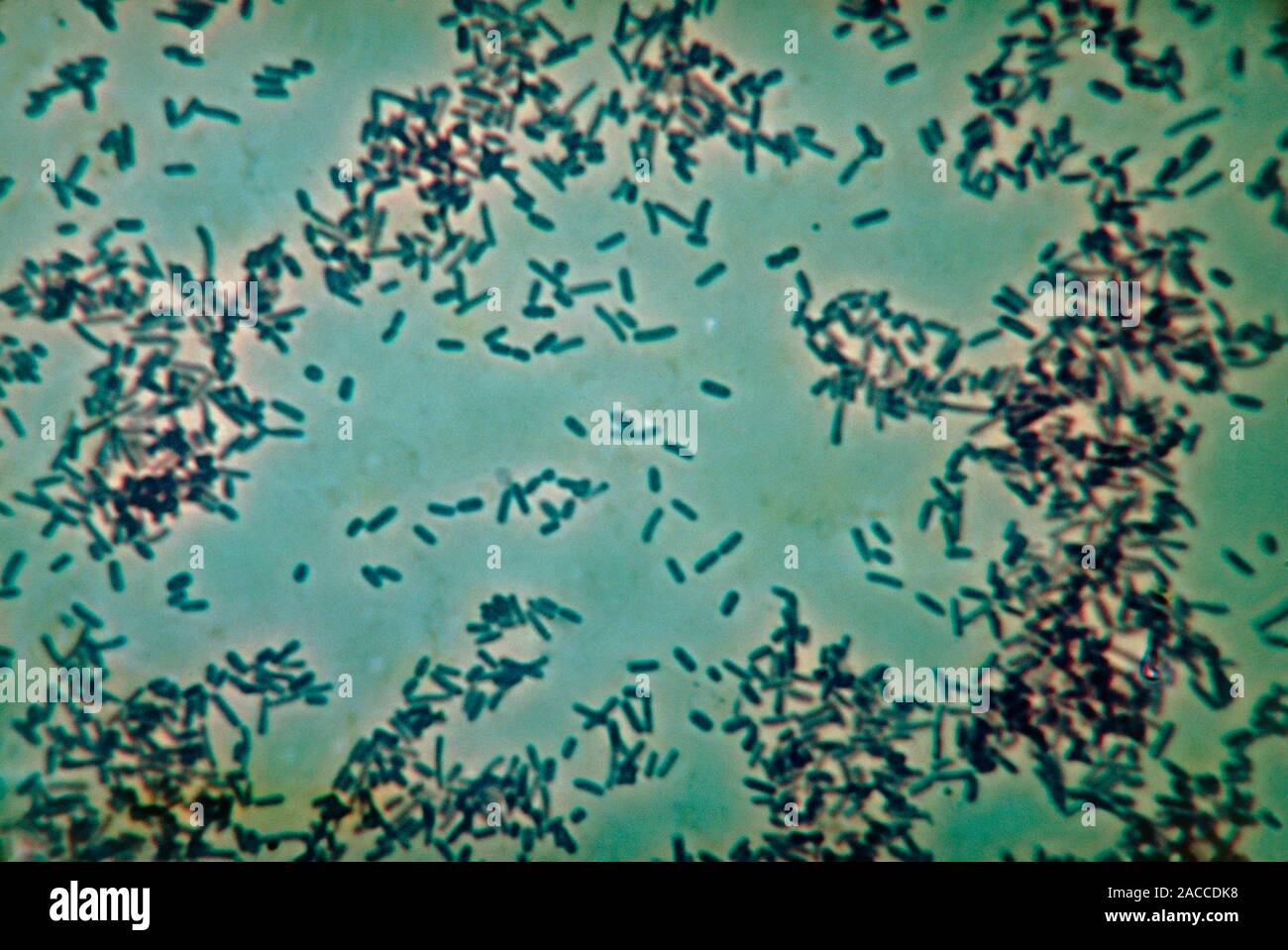 Salmonella typhi. Micrografía de luz de las bacterias Gramnegativas en