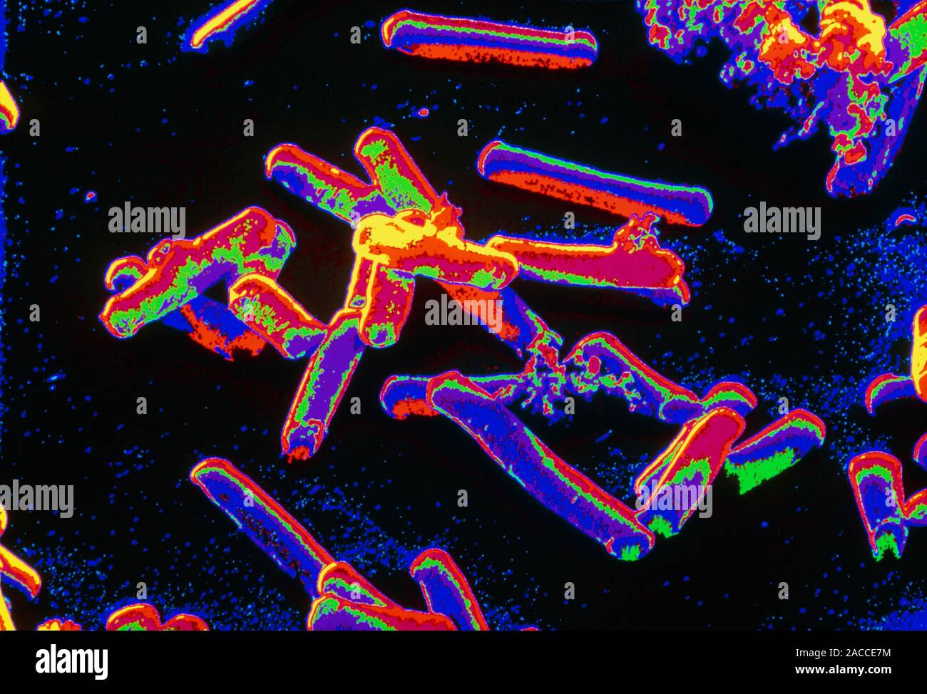 Clostridium Tetani Color Análisis Micrografía De Electrones Sem De