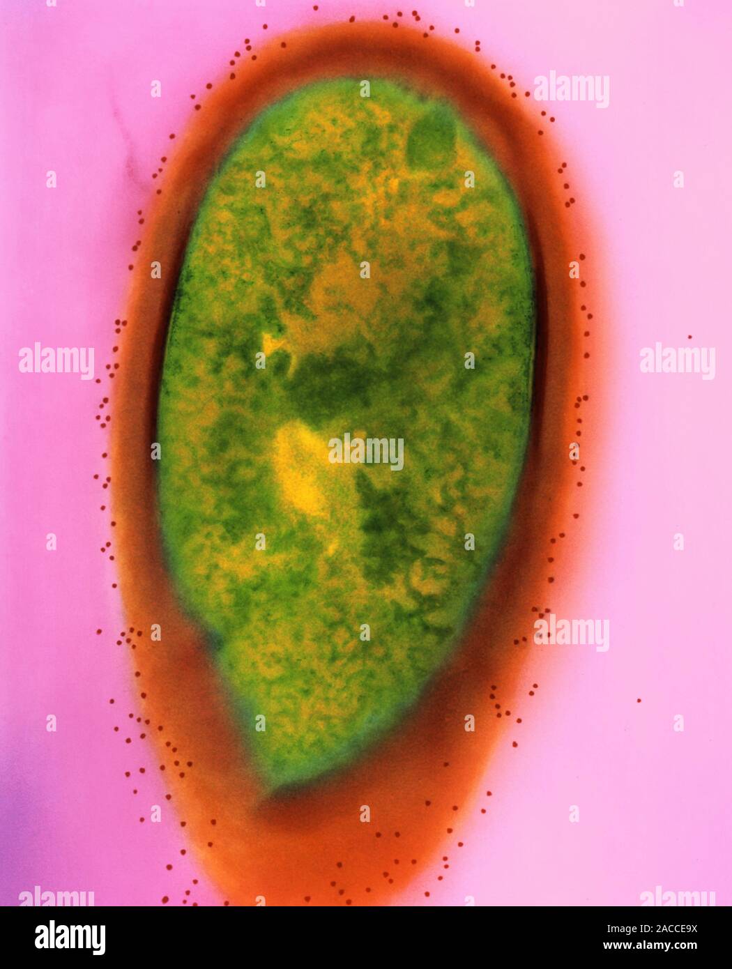 Lactobacillus brevis. Inmunoelectrón microscópico (IEM) Imagen del