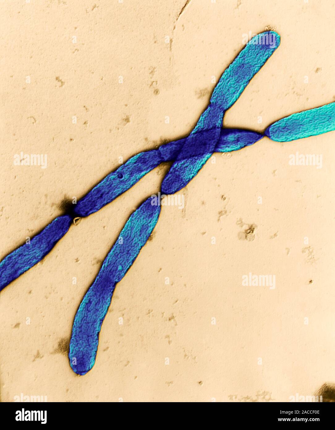Burkholderia mallei bacterias, Color micrografía de electrones de