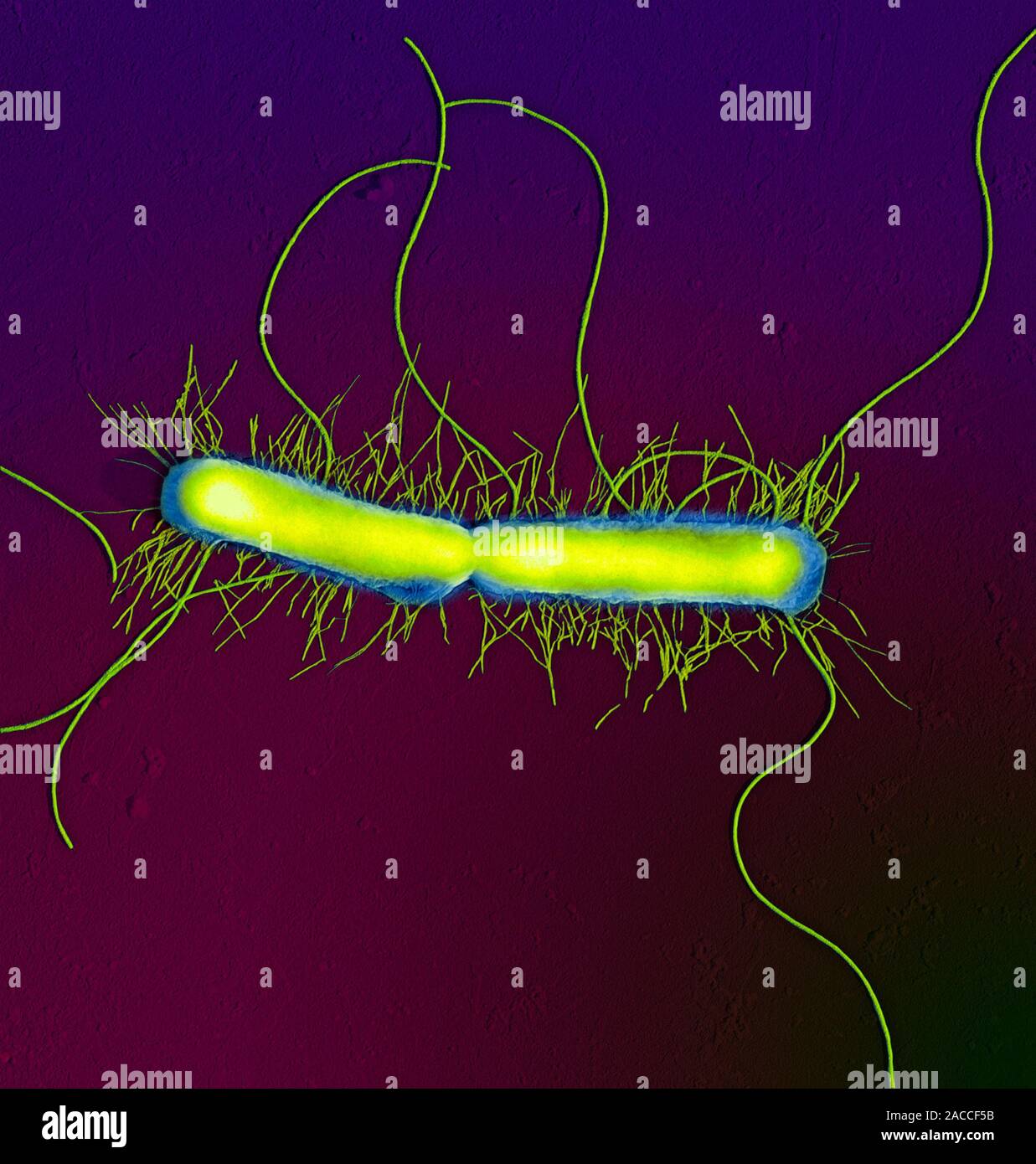 Proteus mirabilis микробиология. Бактерии рода proteus (протеус). Протея магнифика. Бактерии протеи вульгарис. Протея в кишечнике.
