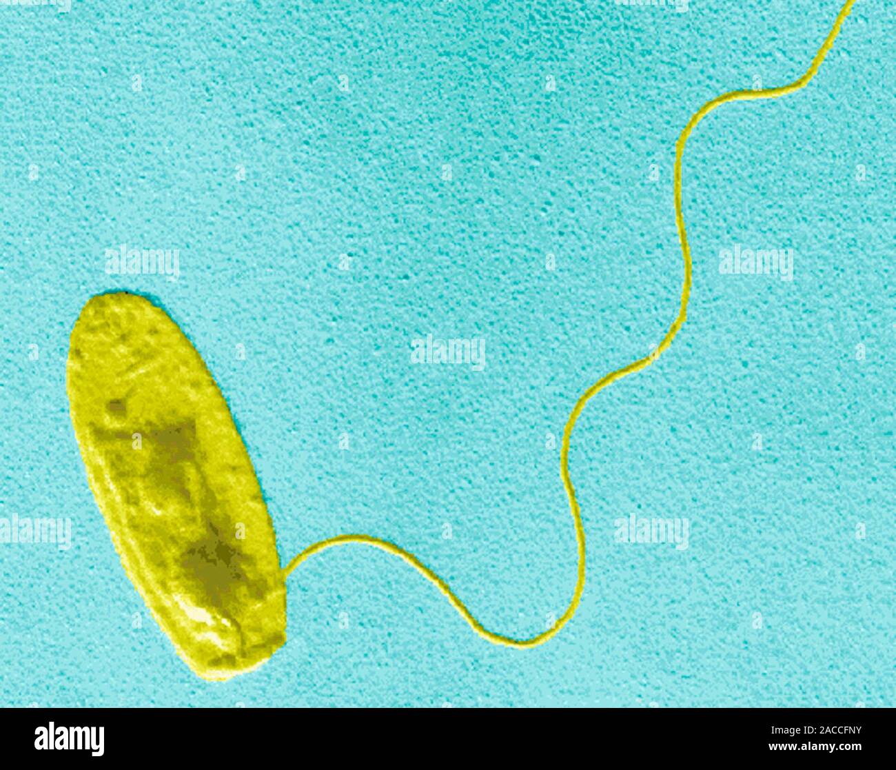 La bacteria Legionella sp., Color micrografía de electrones de