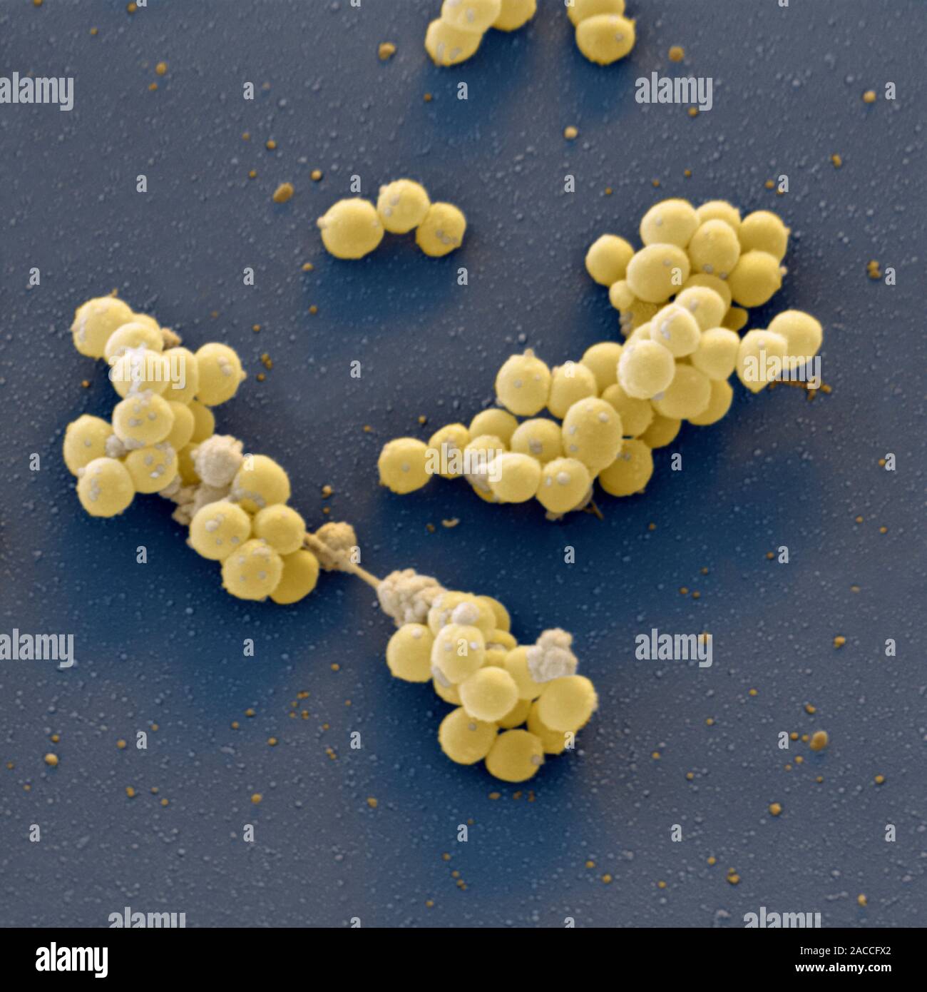 Las Bacterias Staphylococcus Aureus Color Micrografía Análisis De